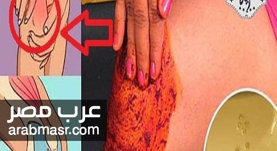 للتخلص من الام الركبة للتخلص من الام الركبة بوصفة طبيعية سهله وبسيطة تحلصك من جميع الام